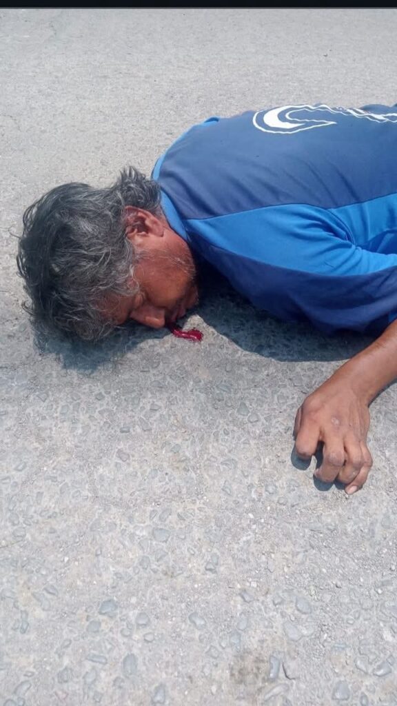 Dejan herido a un hombre frente a escuela del sur de Puebla capital