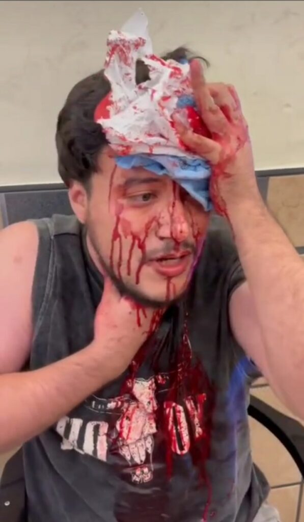 Miembro de la comunidad LGBTT sufrió puñalada en la cabeza dentro de taquería La Oriental