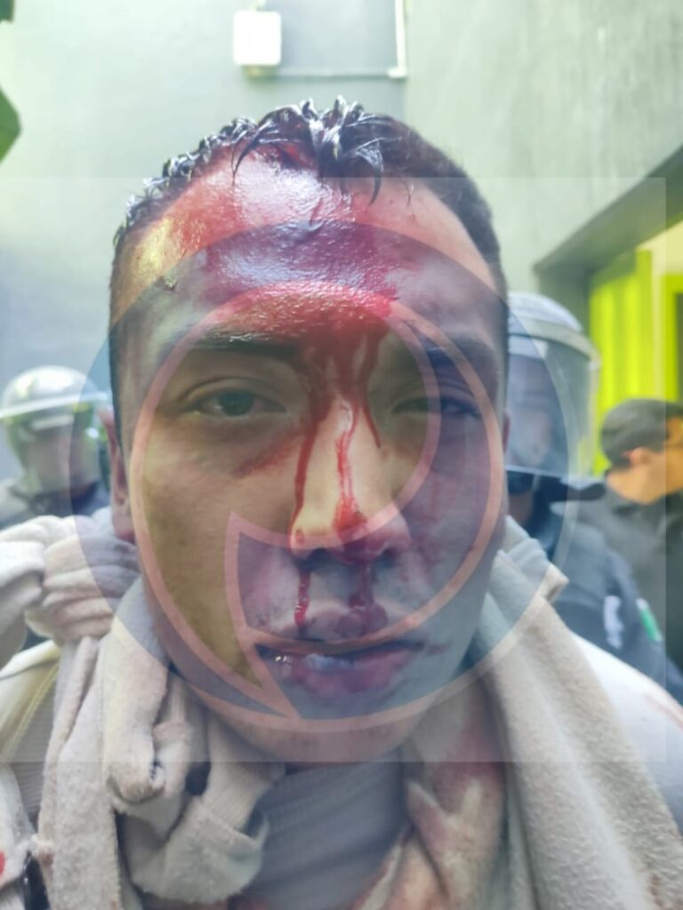 Riña dentro del penal de Tepexi dejó varios heridos