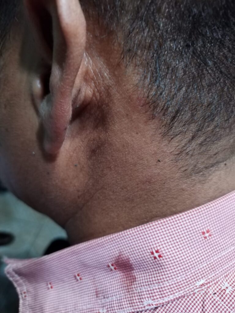 ¡Imparable delincuencia en Puebla capital! atacan a conductor de Uber a plena luz de día y en colonia muy poblada