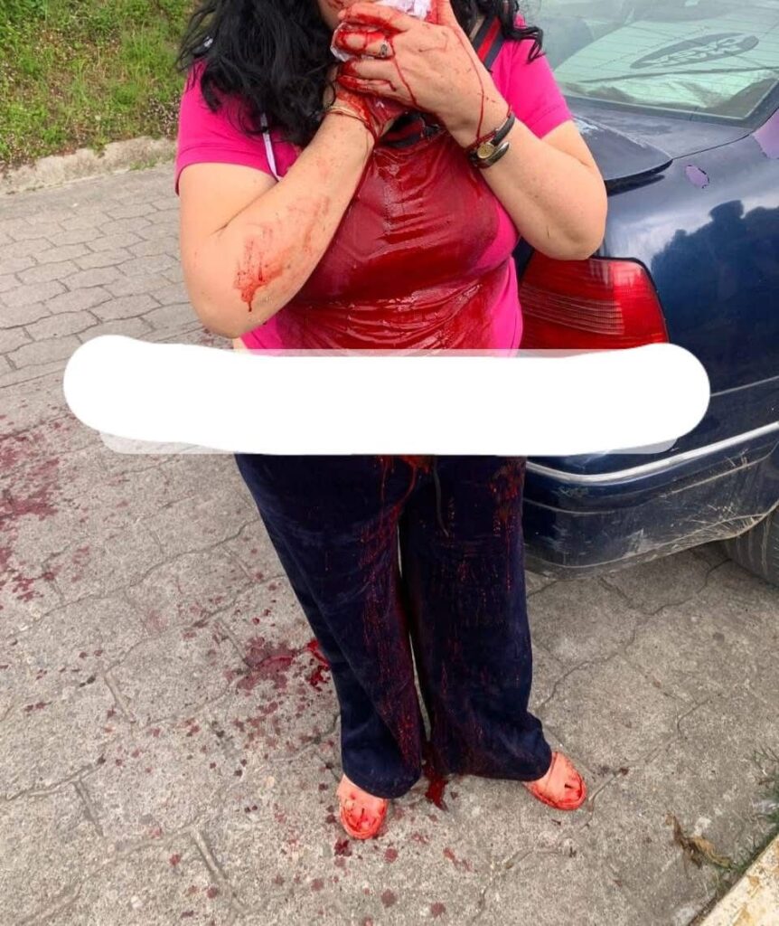 Apuñalan a mujer por intento de asalto en Tlatlauquitepec