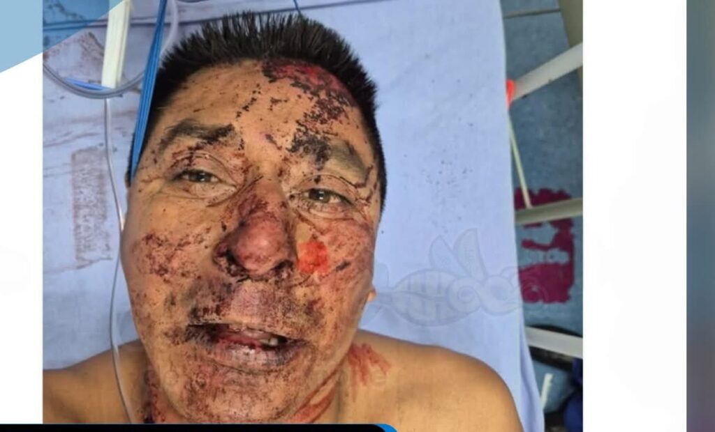 ¡SERVICIO SOCIAL! piden apoyo para encontrar a familiares de hombre accidentado en la autopista México-Tuxpan