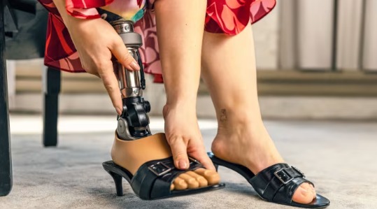 “Ecos del miembro perdido: la realidad oculta del dolor fantasma en México”