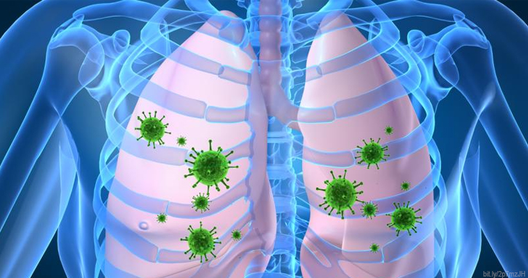 VSR, el virus del que pocos hablan pero que puede causar neumonía grave en adultos mayores