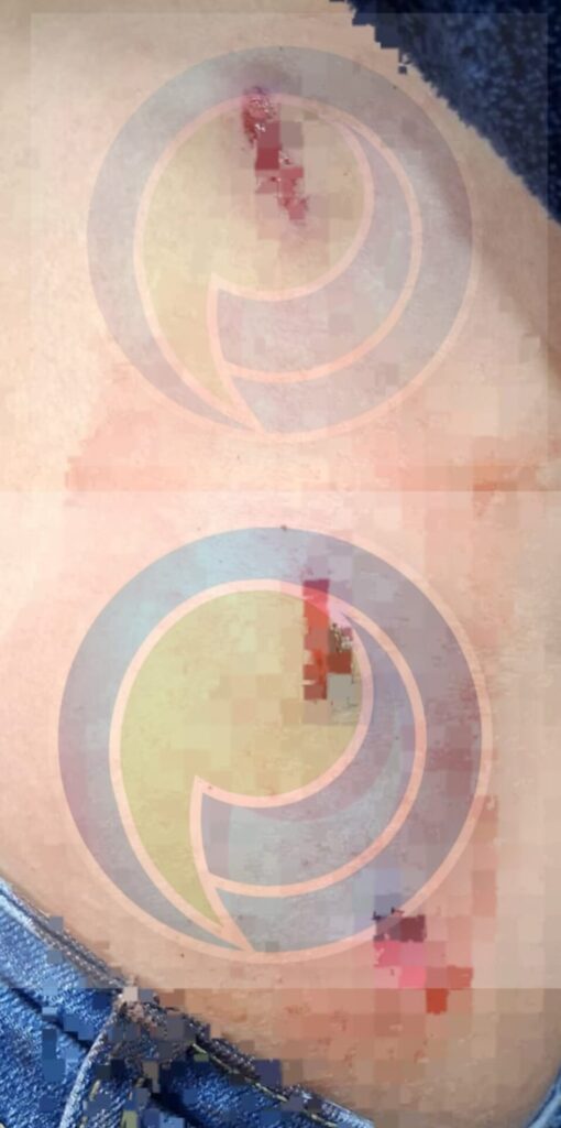 Intento de feminicidio en Amozoc