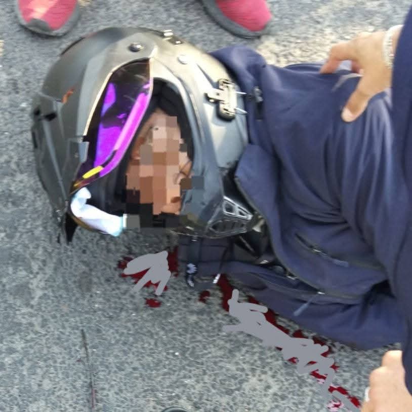 Piden trasladar a motociclista atropellado ayer en la federal México-Tuxpan